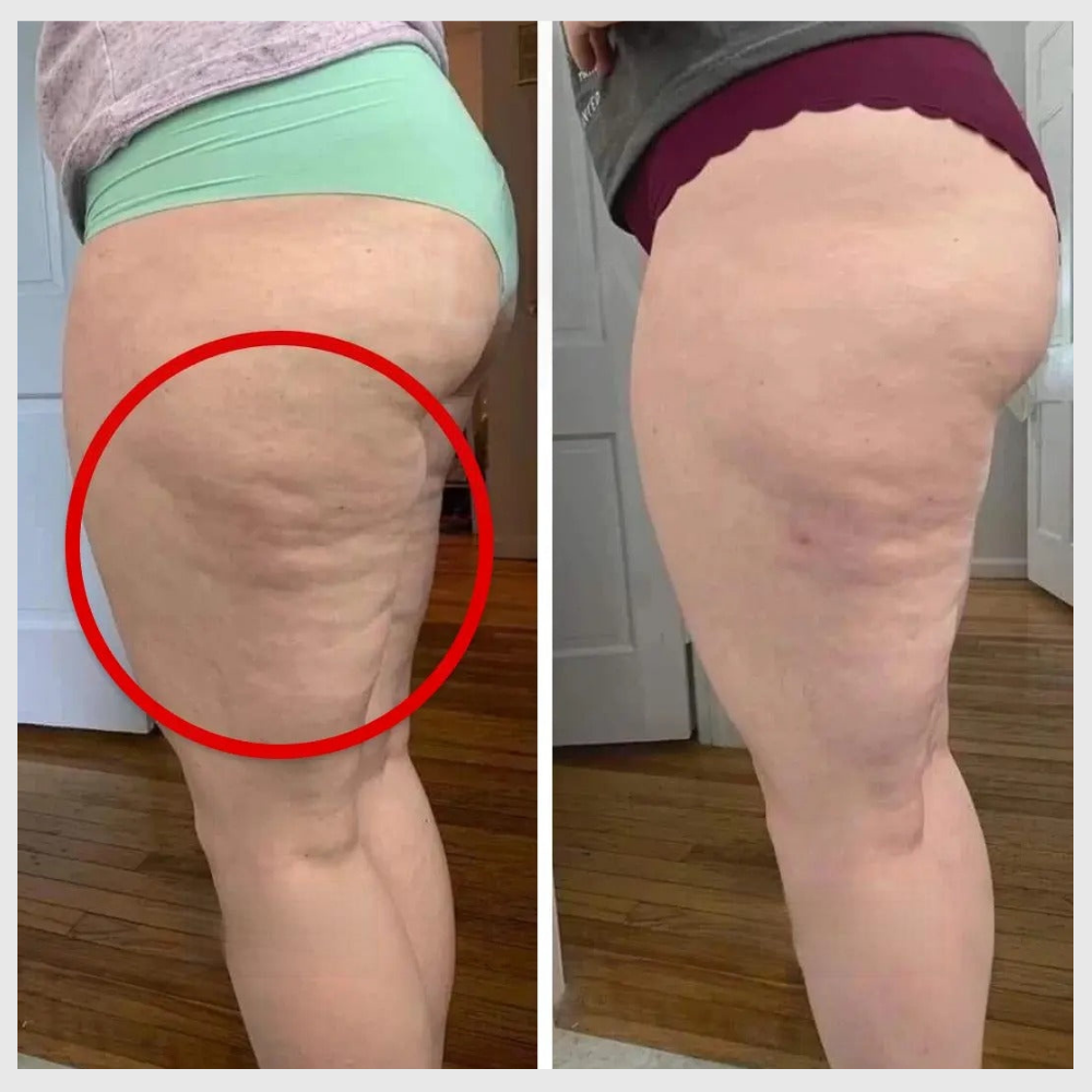 Legging 3D Anti-Cellulite