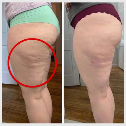 Legging 3D Anti-Cellulite